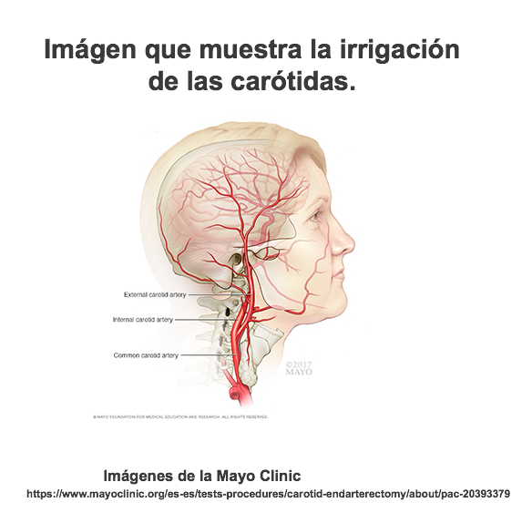 Irrigación