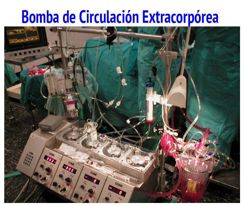 bomba