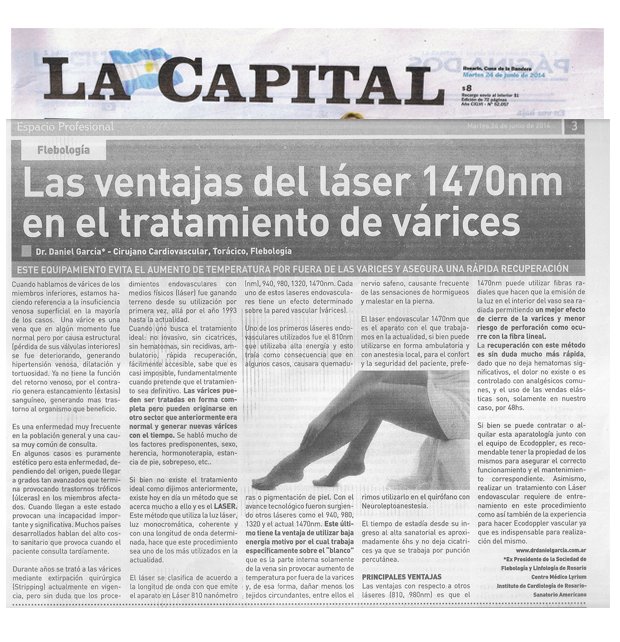 capitlalaser